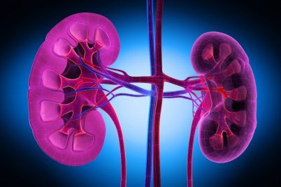 What is Diabetic Nephropathy, Its Stages, Symptoms and Treatment